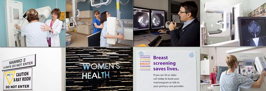 This mammograph provides a 2-dimensional rendering of the mean breast